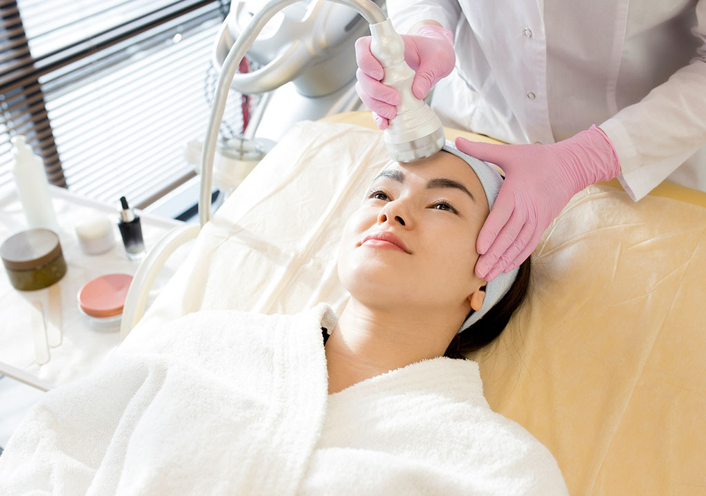 photofacial IPL Treatment