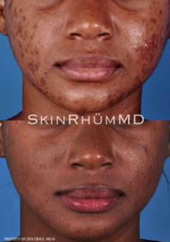 io-600x853-1 io-600x853-1