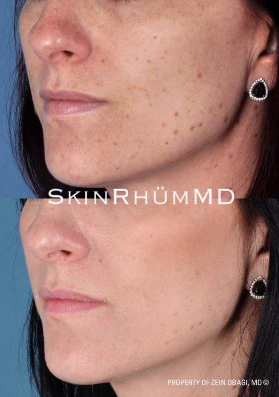 io-600x853-2 io-600x853-2