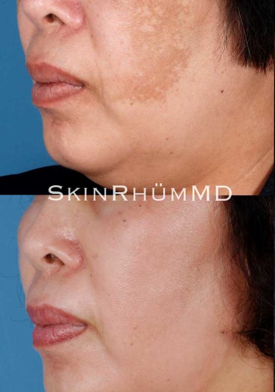 io-600x853-3 io-600x853-3