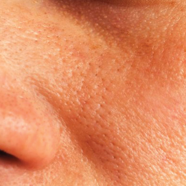 large-pores large-pores