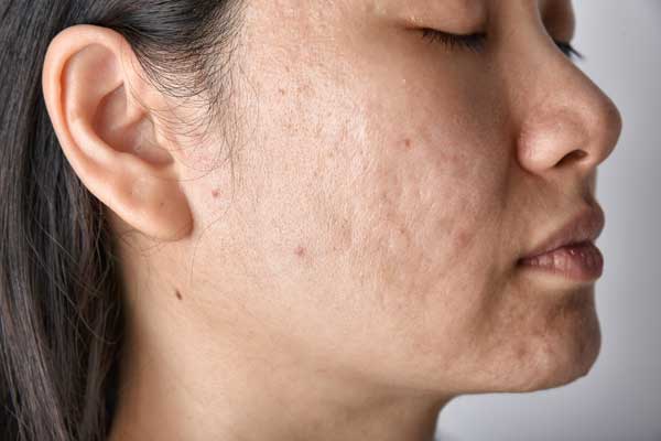 MEDICAL SKIN DISORDERS